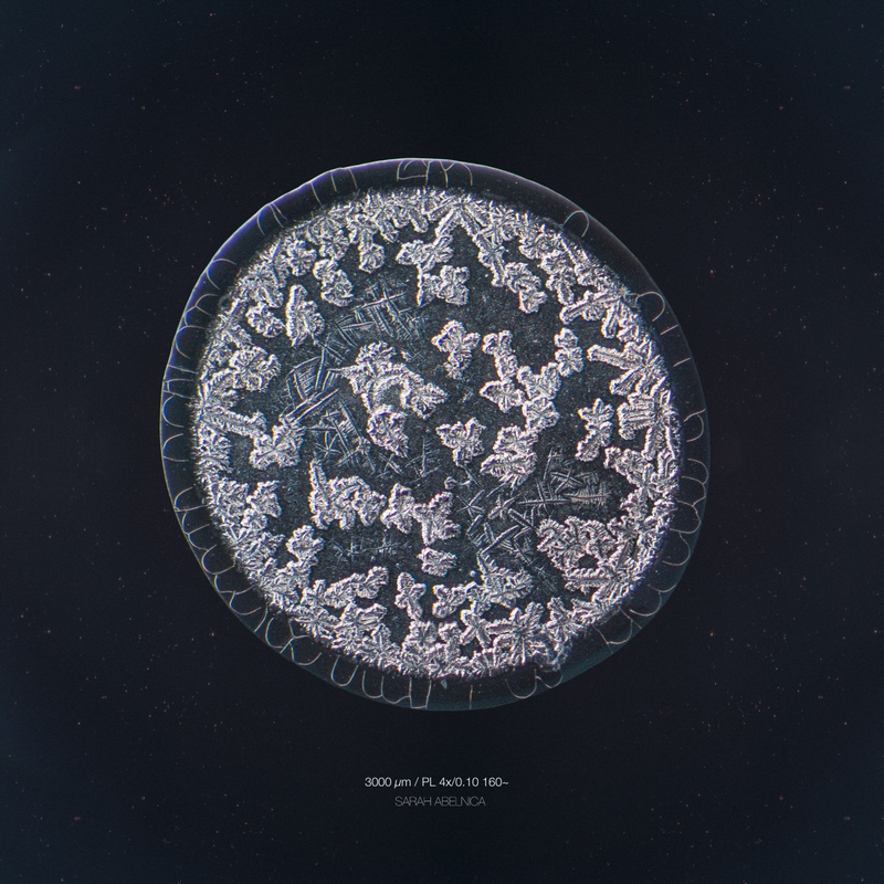 Illustration for article titled The Beautiful Secrets of Tears, Revealed By a Microscope